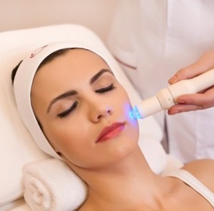 Acne Removal Laser treatment in Nagercoil